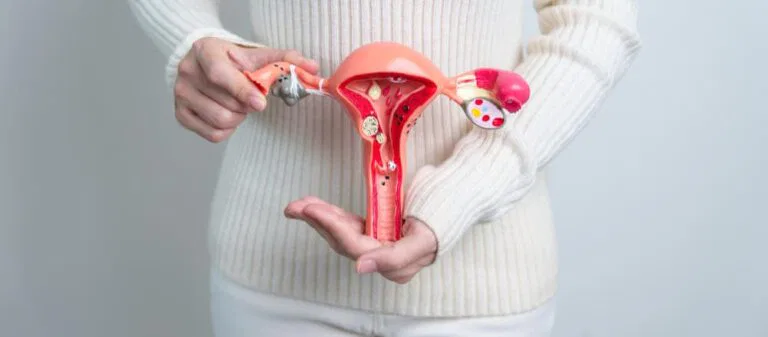 How to Treat Adenomyosis and Reclaim Your Life