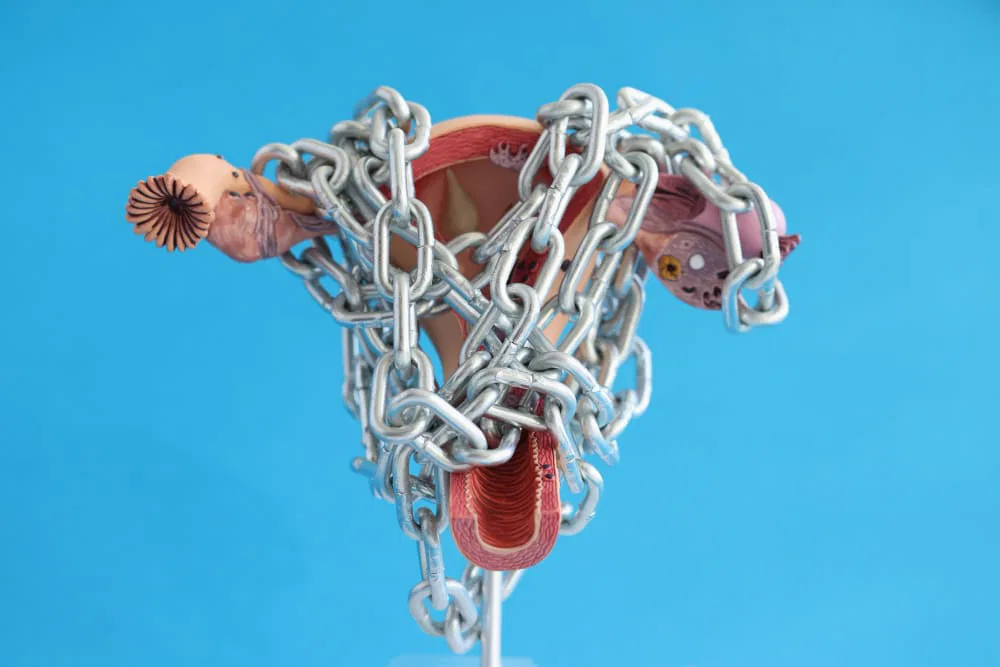 Hysterectomy Side Effects: What Women Need to Know Before Surgery