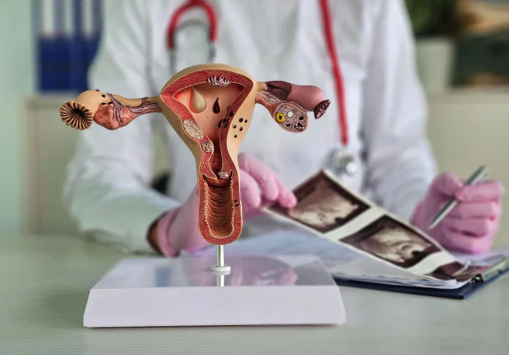 Adenomyosis Symptoms: How to Recognize and Manage the Condition?