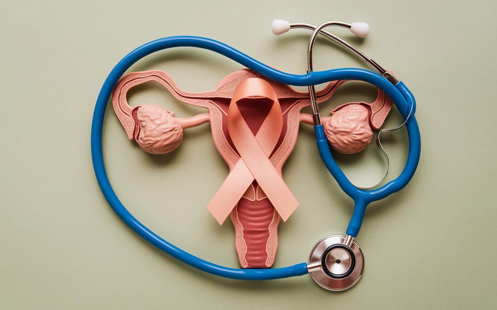 Uterine Artery Embolization for Adenomyosis: A Treatment Invasive Solution